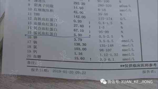 结果在茶室内待了4小时后会怎样（结果在茶室内待了4小时后） 第4张