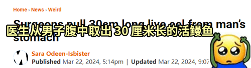 医生从患者肚子里扯出一条活鳗鱼 这不比异形还刺激 第2张