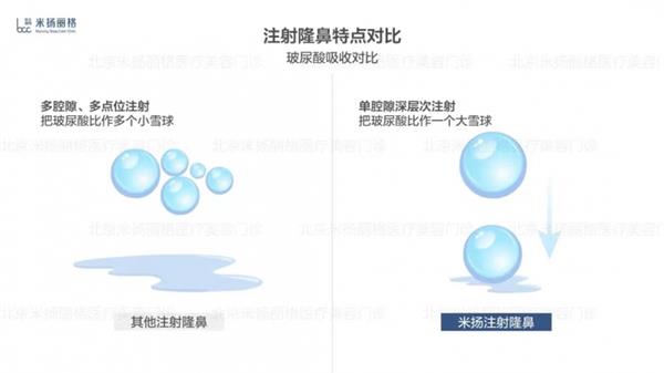 北京米扬丽格李振医生在鼻部注射和轮廓塑形方面的技术应用 第7张