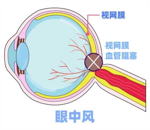 95后妈妈一觉醒来右眼失明！医生：已错过最佳抢救时机 第3张