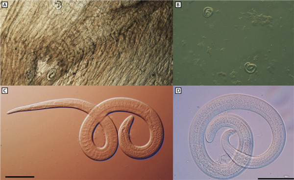 吃了未熟透的熊肉：美国一家6口全部感染致命旋毛虫病 第2张
