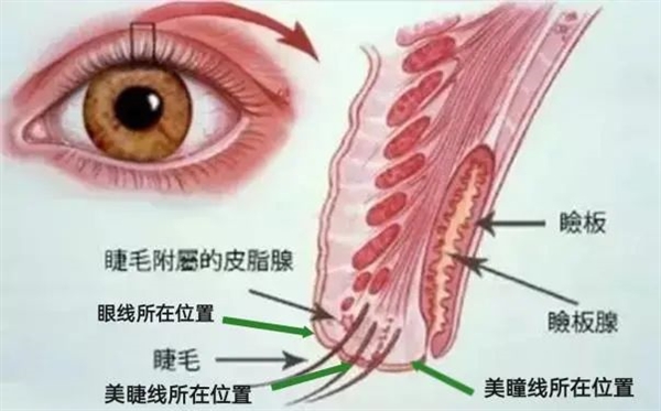 那些纹美瞳线的人 现在都怎么样了？ 第3张