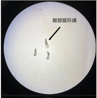 那些纹美瞳线的人 现在都怎么样了？ 第5张