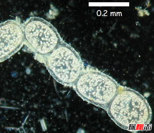 细菌最大有多大?世界上最大的细菌(附图片)(最大细菌是什么) 第5张