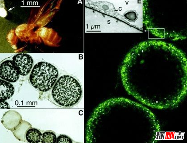 细菌最大有多大?世界上最大的细菌(附图片)(最大细菌是什么) 第7张