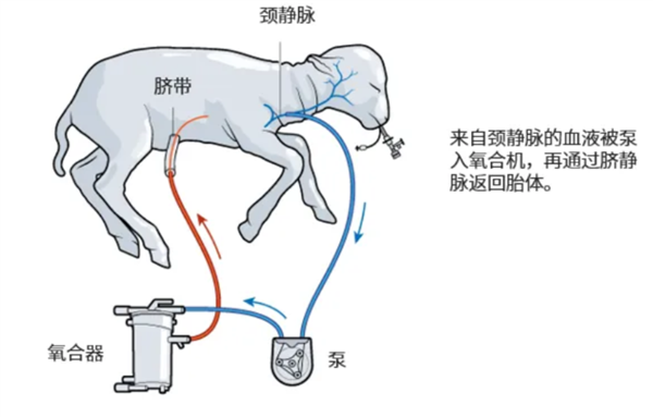 飙上热搜的人造子宫 真的能让男人也怀孕？ 第8张