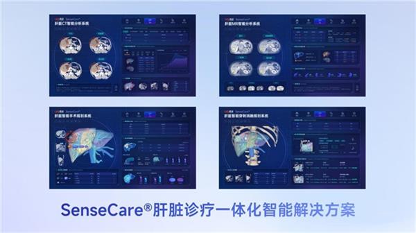 商汤医疗获得肝脏CT辅助诊断产品首张NMPA三类证 赋能肝脏诊疗一体化 第2张