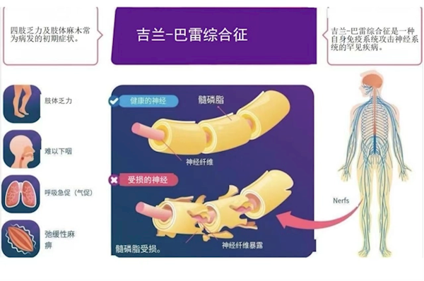 大学生因一顿烧烤进ICU 换了5次血：都怪它 第2张