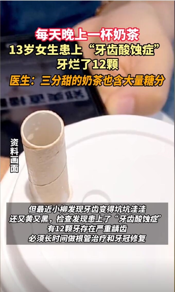 杭州13岁女生每天一杯奶茶牙被腐蚀：患有严重龋齿 第2张