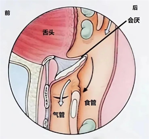 人类身上明显的缺陷：吃饭时发出声音会杀死自己