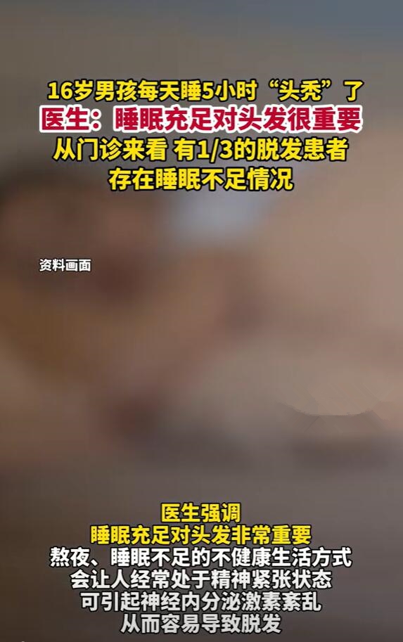 16岁男孩每天只睡5小时头秃了 医生：睡眠不足 精神压力大导致 第2张