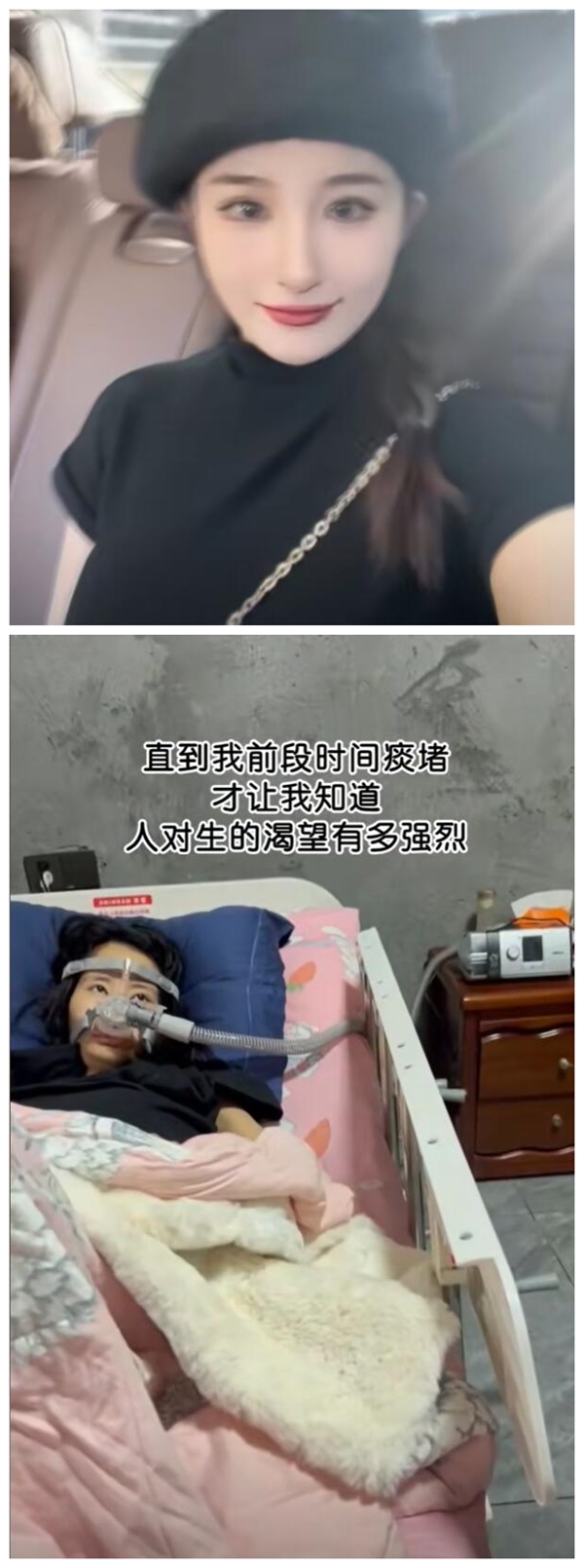 女生确诊渐冻症容貌巨变 母亲回应：刚从ICU出来 一清醒就想做视频 第2张